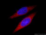 FASN Antibody in Immunocytochemistry (ICC/IF)