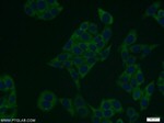 FASN Antibody in Immunocytochemistry (ICC/IF)