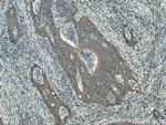 FASN Antibody in Immunohistochemistry (Paraffin) (IHC (P))