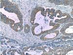 FADS1 Antibody in Immunohistochemistry (Paraffin) (IHC (P))