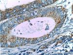 FADS1 Antibody in Immunohistochemistry (Paraffin) (IHC (P))