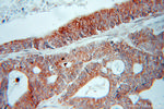 FADS1 Antibody in Immunohistochemistry (Paraffin) (IHC (P))