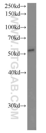 FADS1 Antibody in Western Blot (WB)