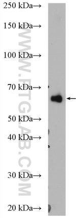 EEFSEC Antibody in Western Blot (WB)