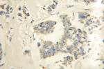 RNF34 Antibody in Immunohistochemistry (Paraffin) (IHC (P))