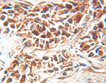 EEF1D Antibody in Immunohistochemistry (Paraffin) (IHC (P))