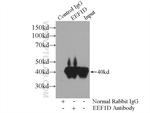 EEF1D Antibody in Immunoprecipitation (IP)