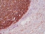 Podoplanin (PDPN) (Lymphatic Endothelial and Mesothelial Marker) Antibody in Immunohistochemistry (Paraffin) (IHC (P))