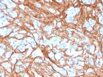 Periostin (POSTN) Antibody in Immunohistochemistry (Paraffin) (IHC (P))