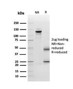 Periostin (POSTN) Antibody in SDS-PAGE (SDS-PAGE)