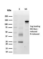 Periostin (POSTN) Antibody in SDS-PAGE (SDS-PAGE)