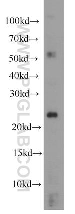 RHOC Antibody in Western Blot (WB)