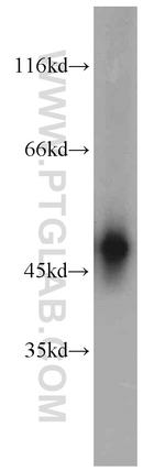 DLK1 Antibody in Western Blot (WB)