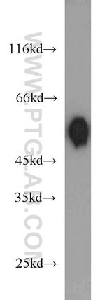 DLK1 Antibody in Western Blot (WB)