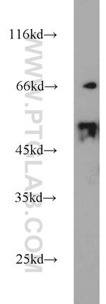 DLK1 Antibody in Western Blot (WB)