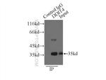 REDD1 Antibody in Immunoprecipitation (IP)