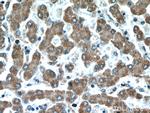 REDD1 Antibody in Immunohistochemistry (Paraffin) (IHC (P))