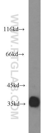 REDD1 Antibody in Western Blot (WB)