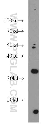 REDD1 Antibody in Western Blot (WB)