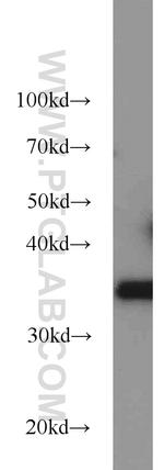 REDD1 Antibody in Western Blot (WB)