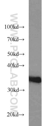 REDD1 Antibody in Western Blot (WB)