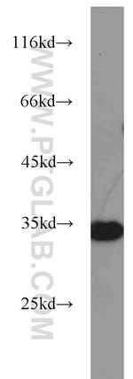 REDD1 Antibody in Western Blot (WB)