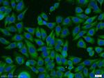 PACSIN3 Antibody in Immunocytochemistry (ICC/IF)