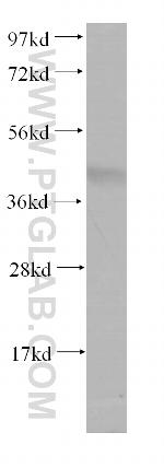 PACSIN3 Antibody in Western Blot (WB)