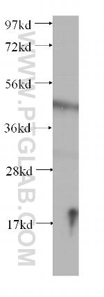 PACSIN3 Antibody in Western Blot (WB)