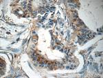 Placental Growth Factor Antibody in Immunohistochemistry (Paraffin) (IHC (P))