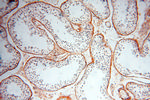 EMILIN1 Antibody in Immunohistochemistry (Paraffin) (IHC (P))