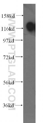 EMILIN1 Antibody in Western Blot (WB)