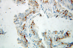 ERAB Antibody in Immunohistochemistry (Paraffin) (IHC (P))