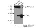 ERAB Antibody in Immunoprecipitation (IP)