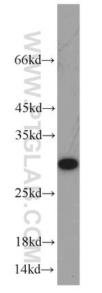 ERAB Antibody in Western Blot (WB)