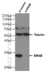 ERAB Antibody in Western Blot (WB)