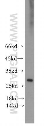 ERAB Antibody in Western Blot (WB)