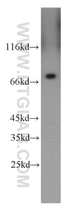 Hsc70 Antibody in Western Blot (WB)