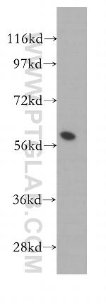 FKBP52 Antibody in Western Blot (WB)