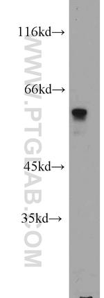 FKBP52 Antibody in Western Blot (WB)