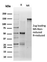 DMRT2 (Transcription Factor) Antibody in Immunoelectrophoresis (IE)