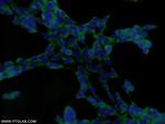 DENR Antibody in Immunocytochemistry (ICC/IF)