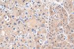 DENR Antibody in Immunohistochemistry (Paraffin) (IHC (P))