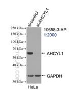 AHCYL1 Antibody in Western Blot (WB)