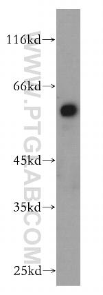 AHCYL1 Antibody in Western Blot (WB)