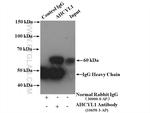 AHCYL1 Antibody in Immunoprecipitation (IP)