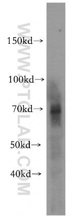 NF2 Antibody in Western Blot (WB)