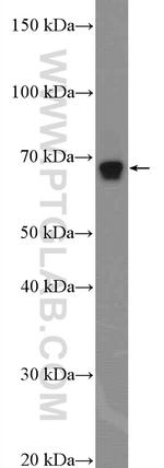 NF2 Antibody in Western Blot (WB)