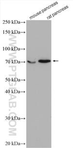 XPNPEP1 Antibody in Western Blot (WB)