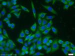 IL18 Antibody in Immunocytochemistry (ICC/IF)